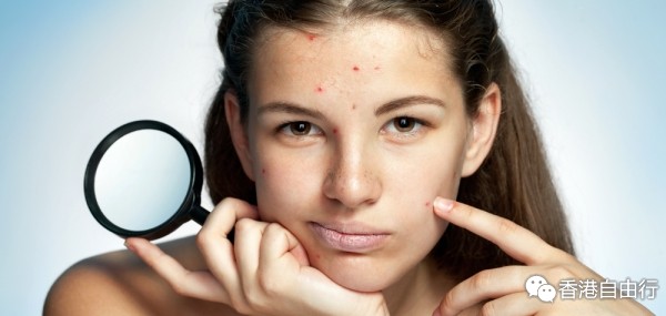 暗疮警号！告诉你身体哪里出了问题！有效祛痘产品大晒冷