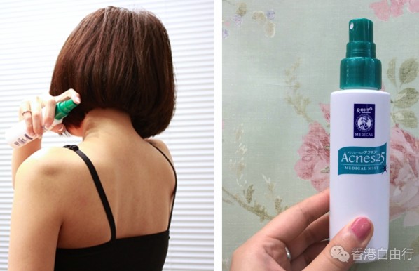 香港购物：日本到港！终于有得卖这支曼秀雷敦 Acnes25 背脊暗疮护理喷雾啦（附价格）